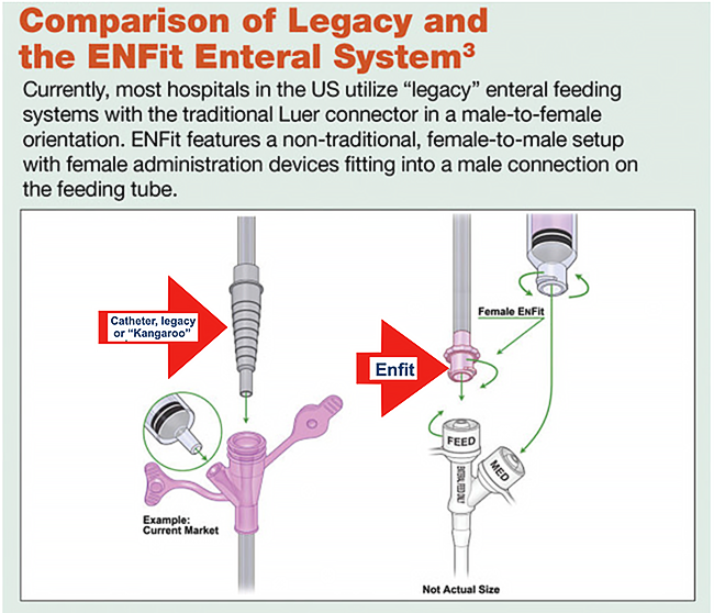 feeding tubes als