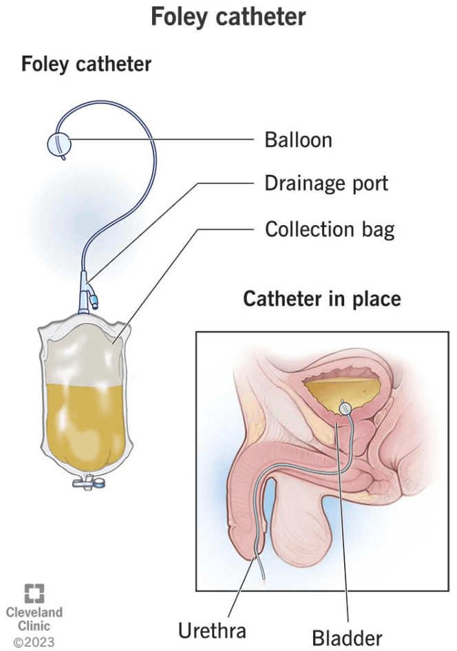 Constipation, Elimination and Urination - image11-2